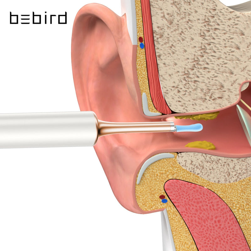 Bebird T15 X3: um limpador de ouvido